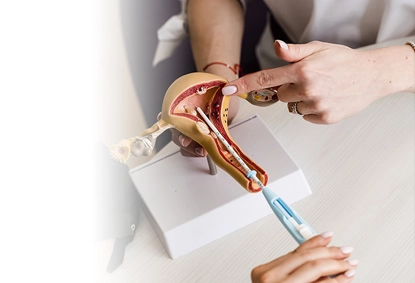 IUI Treatment Explained: What You Need to Know Before Starting